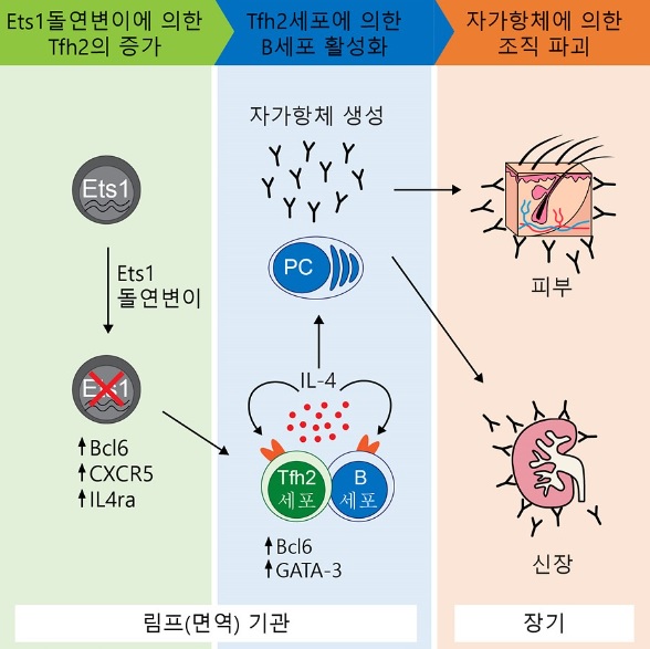 의대 서창희 교수 연구팀, 난치성 질환 '루푸스' 발병원인 규명